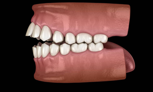 types of oral bacteria